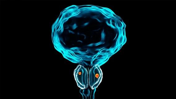 Prostate cancer